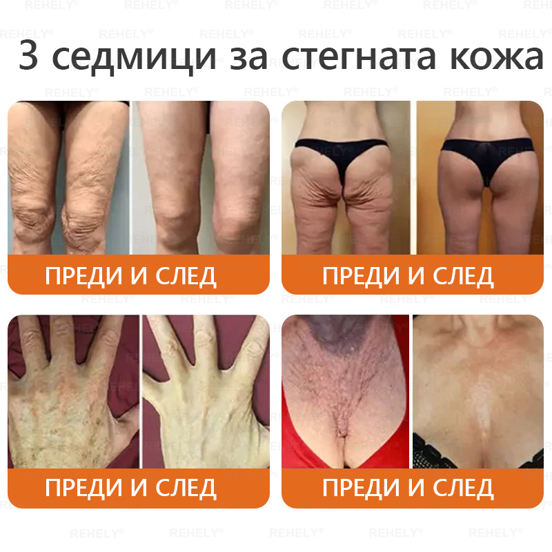 REHELY® Крем с пчелна отрова за регенерация на кожата – Подходящ за всички възрасти и типове кожа)