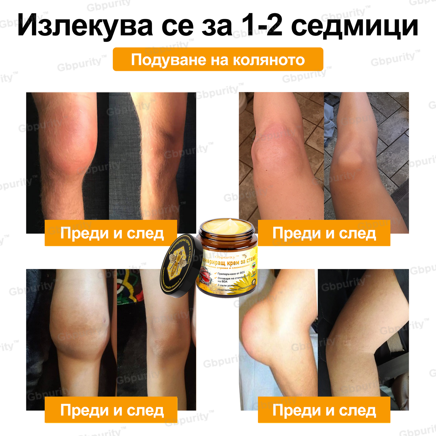 Gbpurity™ Регенериращ крем за стави с пчелна отрова и глюкозамин — Сертифициран от Българското ортопедично дружество (BOS)