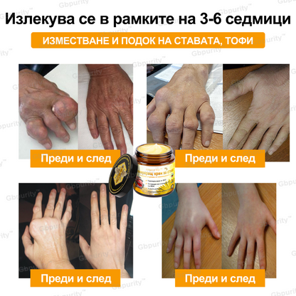Gbpurity™ Регенериращ крем за стави с пчелна отрова и глюкозамин — Сертифициран от Българското ортопедично дружество (BOS)