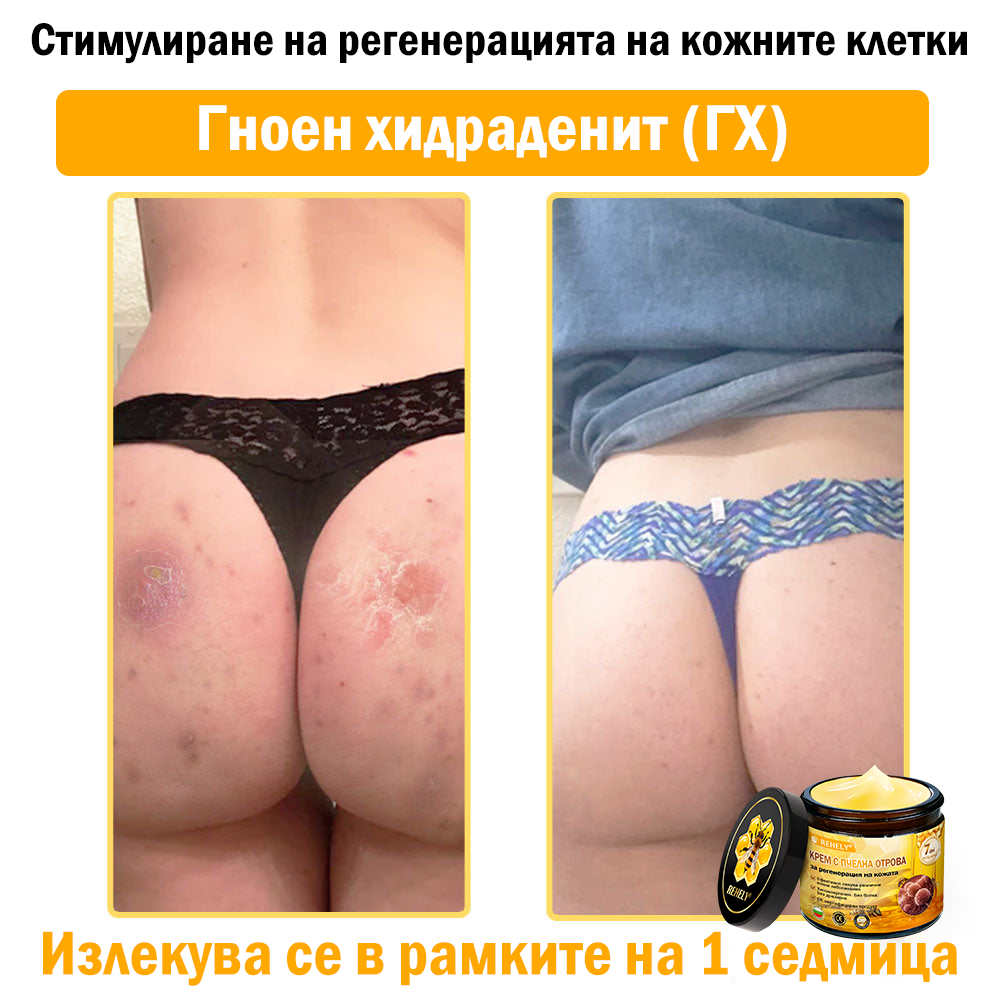 🎁Специалната оферта ви очаква! Ексклузивна еднократна оферта само за Вас! Побързайте – специалната оферта изтича скоро!