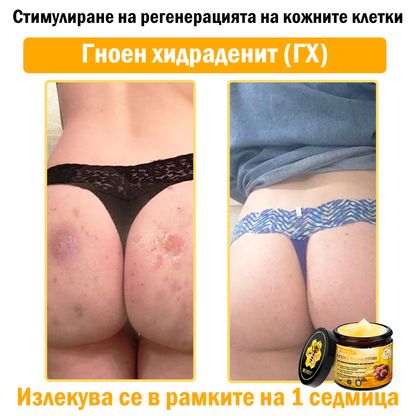 🎁Специалната оферта ви очаква! Ексклузивна еднократна оферта само за Вас! Побързайте – специалната оферта изтича скоро!