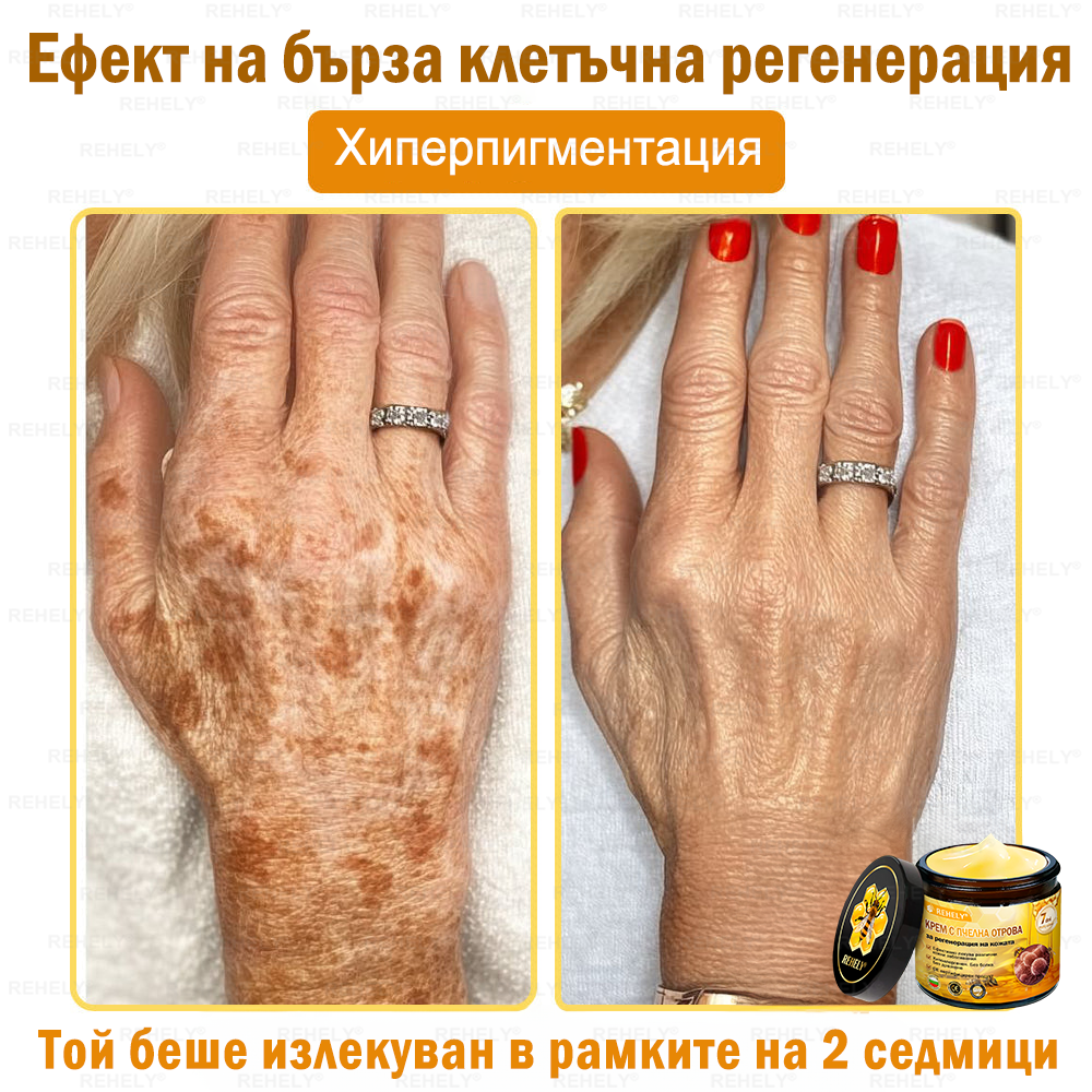 ✨Специалната оферта ви очаква! Ексклузивна еднократна оферта само за Вас! Побързайте – специалната оферта изтича скоро!