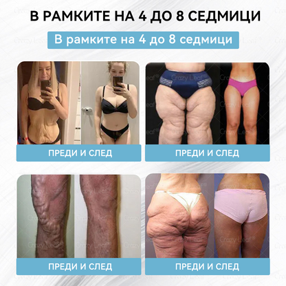 ✨България – Клинично потвърдено | Официален магазин | CrazyLeaf® Slim & Vitality Tirzepatide – орален разтвор, който подкрепя отслабването, кръвното налягане и нивата на захар