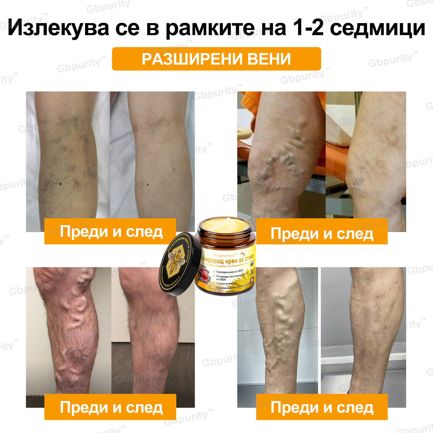 Gbpurity™ Регенериращ крем за стави с пчелна отрова и глюкозамин — Сертифициран от Българското ортопедично дружество (BOS)