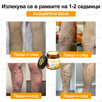 Gbpurity™ Регенериращ крем за стави с пчелна отрова и глюкозамин — Сертифициран от Българското ортопедично дружество (BOS)