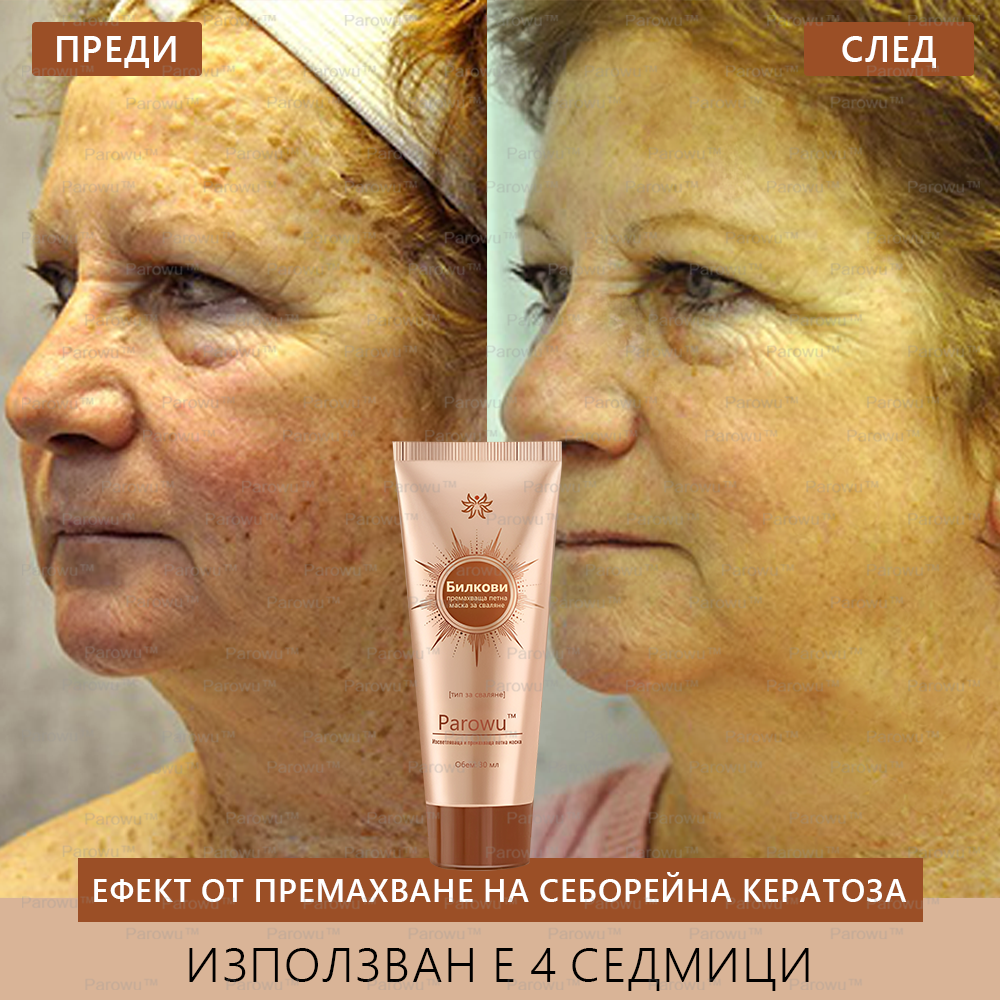 Parowu™ Изсветляваща и премахваща петна маска (✨Натурални съставки за дълготрайно премахване на петна, хиперпигментации и слънчеви петна)