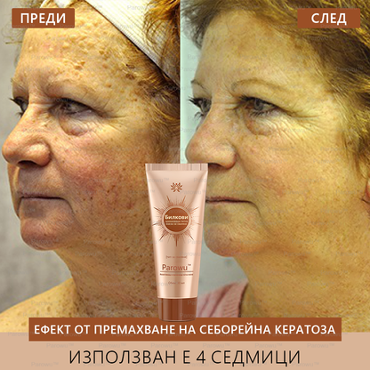 Parowu™ Изсветляваща и премахваща петна маска (✨Натурални съставки за дълготрайно премахване на петна, хиперпигментации и слънчеви петна)